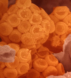 Vortrag zu parasitären Erkrankungen im Naturmuseum  am 9. September